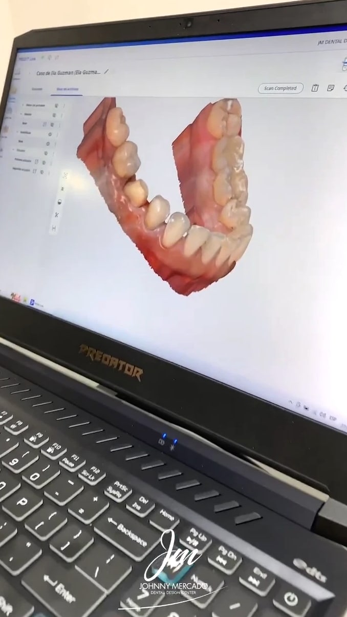 Medit i700 + SIRONA CEREC MCXL + Ivoclar CS Oven - Complete Chairside System