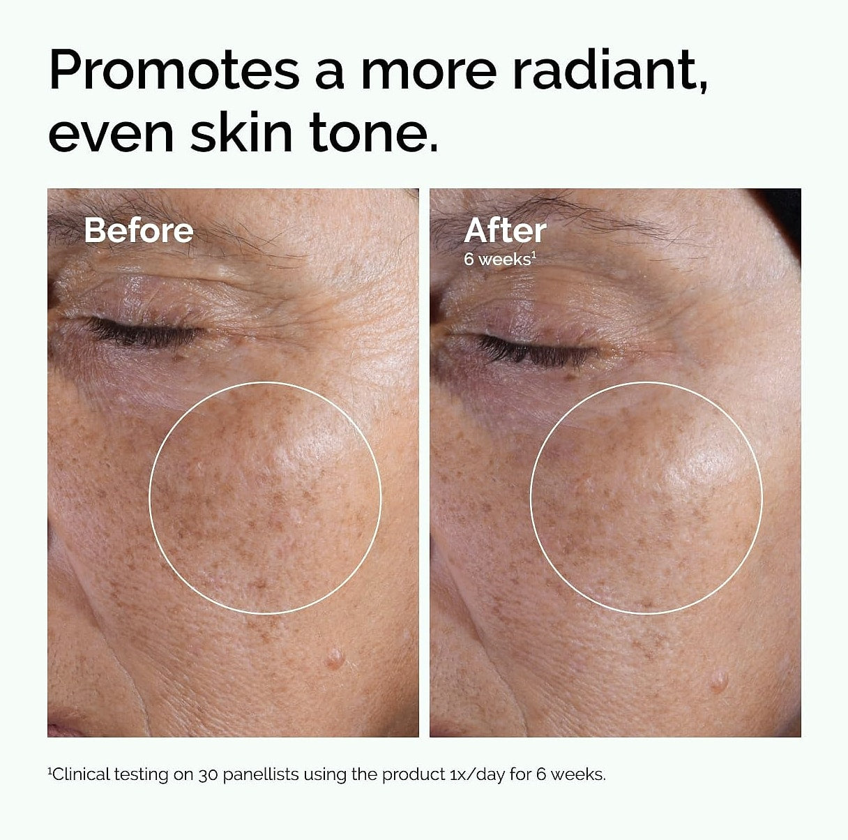 The Ordinary Glycolic Acid 7% Exfoliating Toner for Even Skin Tone