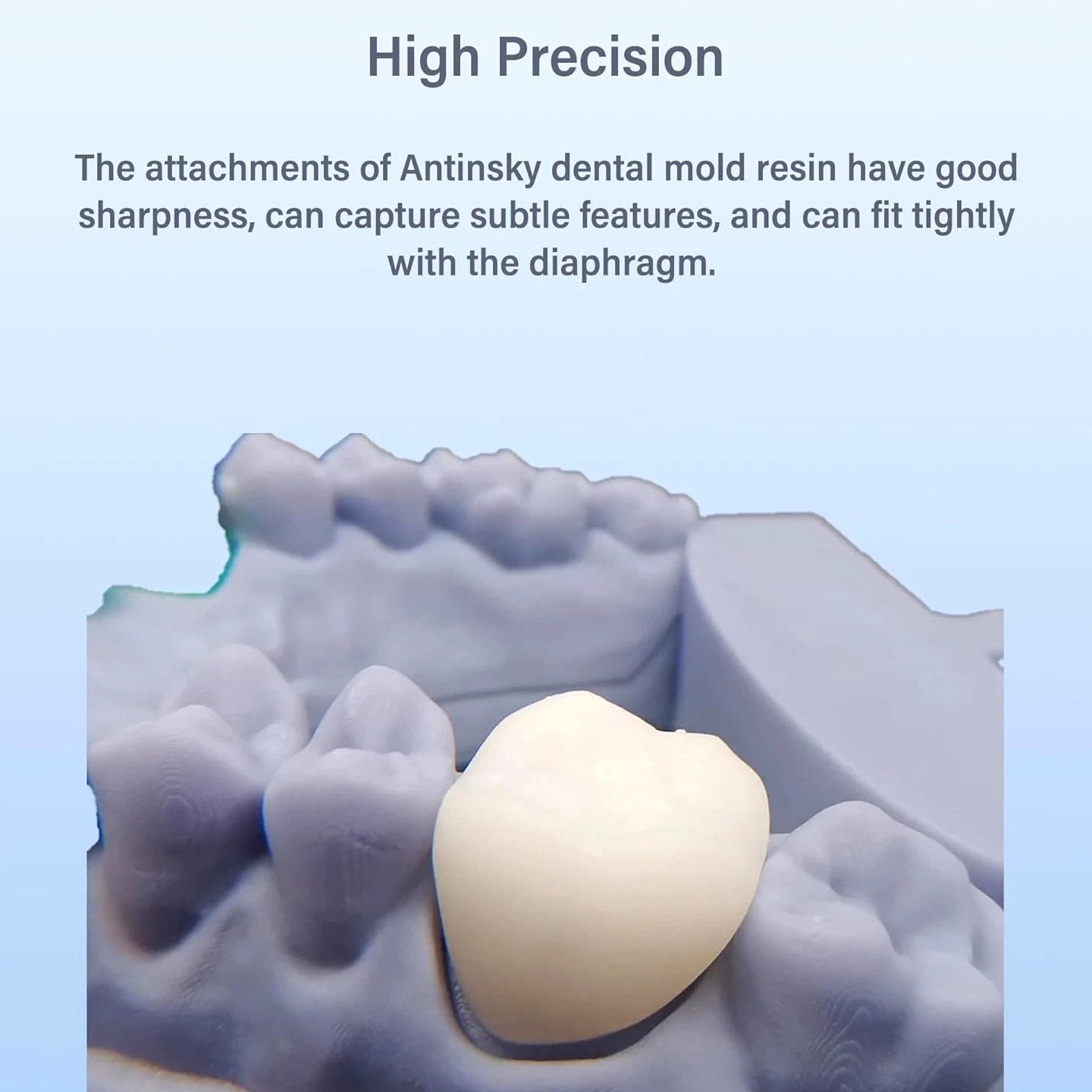 Antinsky Temporary Dental Model Resin for DLP LCD 3D Printer Resin, 405nm High