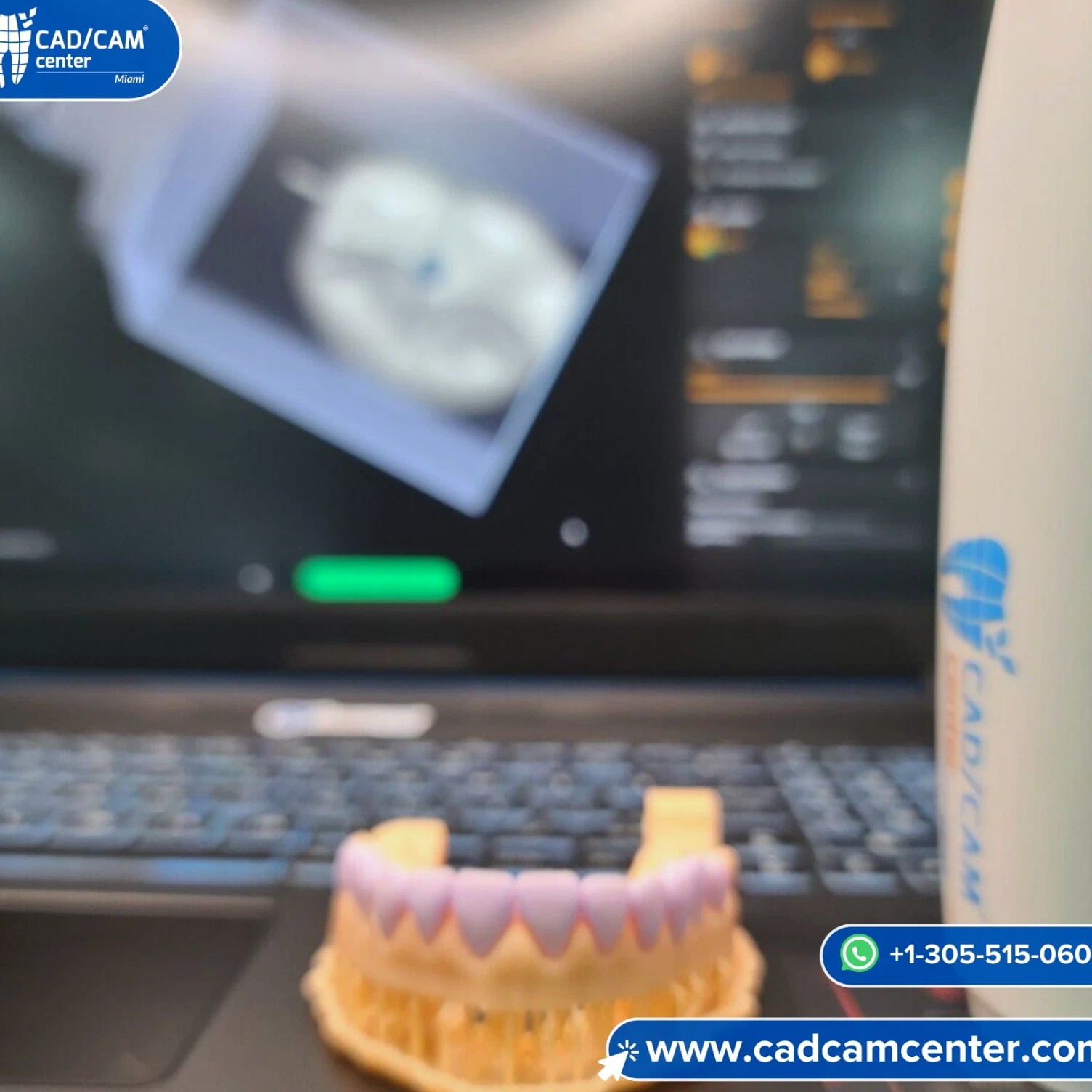Medit i700 + SIRONA CEREC MCXL + Ivoclar CS Oven - Complete Chairside System