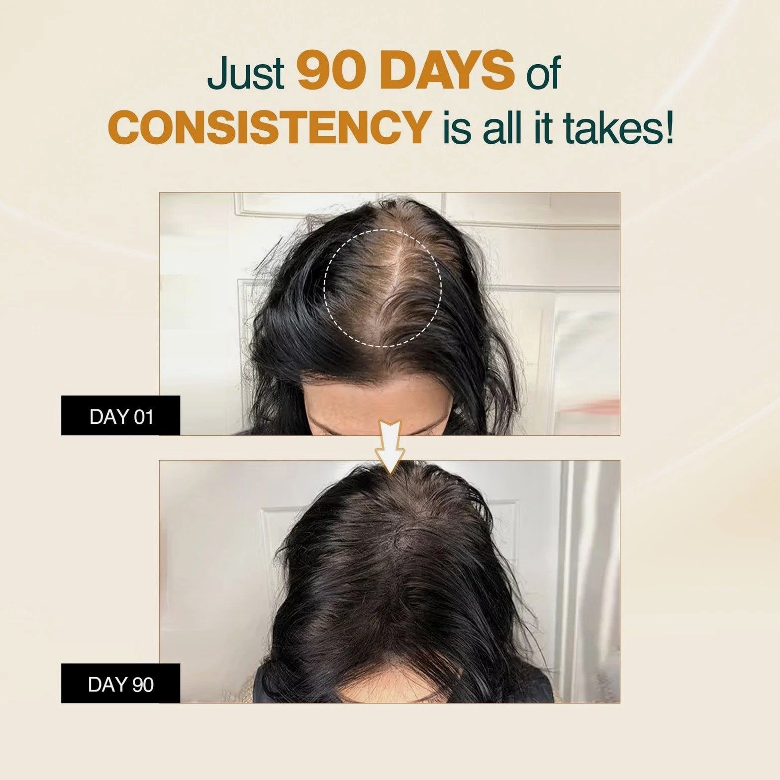 Advanced Hair Growth Vitalizer 50ml, 3% Redensyl, 2% Anagain, 2% Procapil, 5% Rice Water...