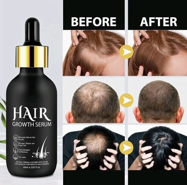 Hair Growth Serum with Biotin 2.02 fL oz - Unisex Hair Loss Treatment
