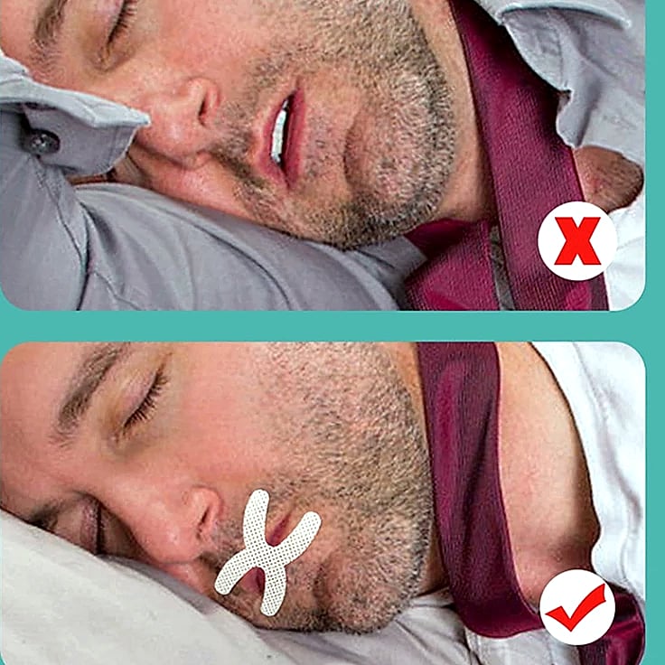 30-Pack X-Shape Mouth Tape Sleep Strips Anti-Snoring