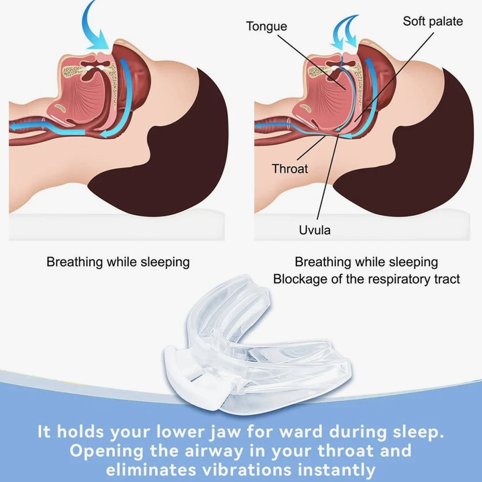 Adjustable Anti Snoring Bruxism Mouth Guard AntiSnoring Mouthpiece Improve Sleep