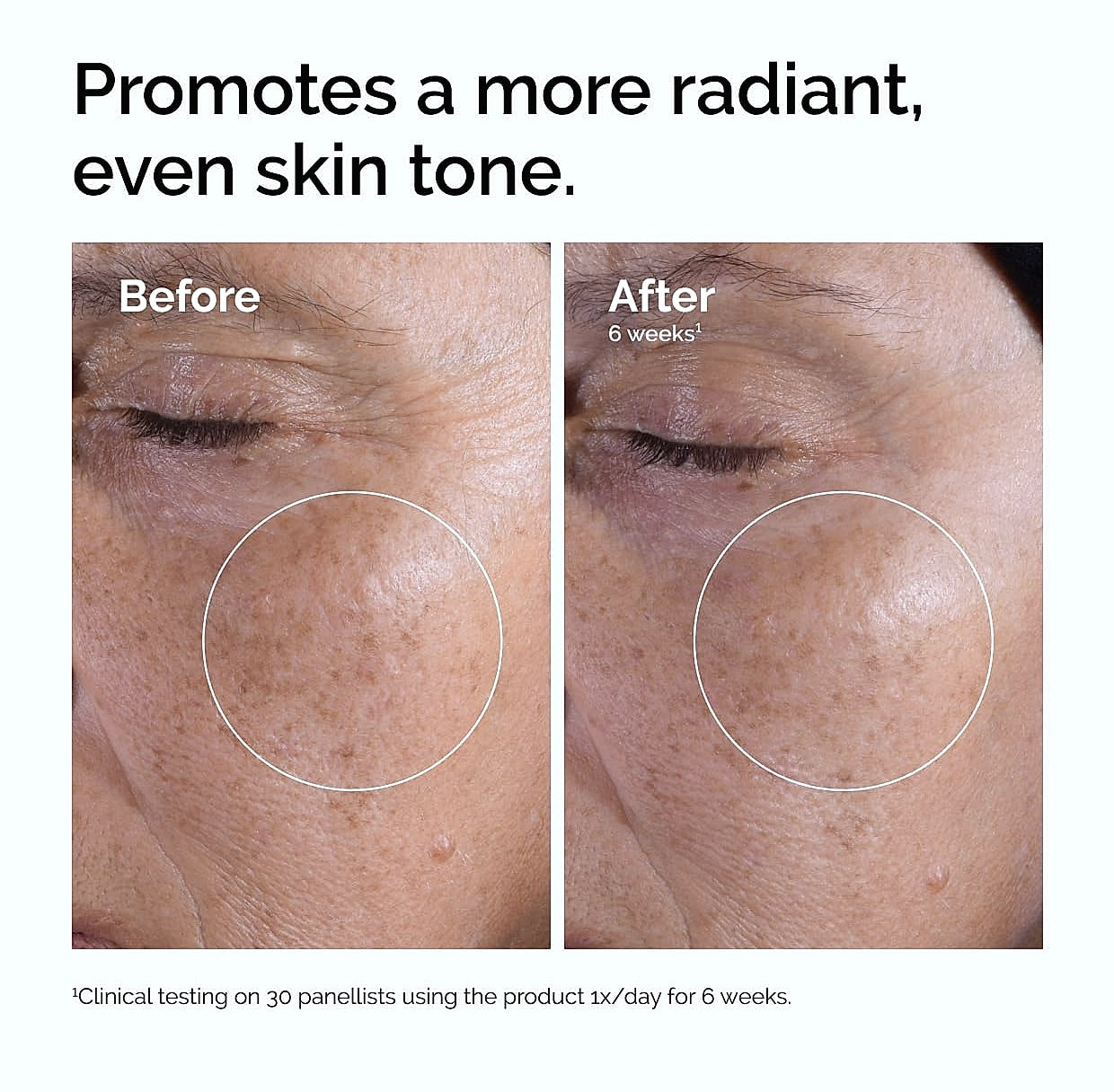 The Ordinary Glycolic Acid 7% Exfoliating Toner for Even Skin Tone