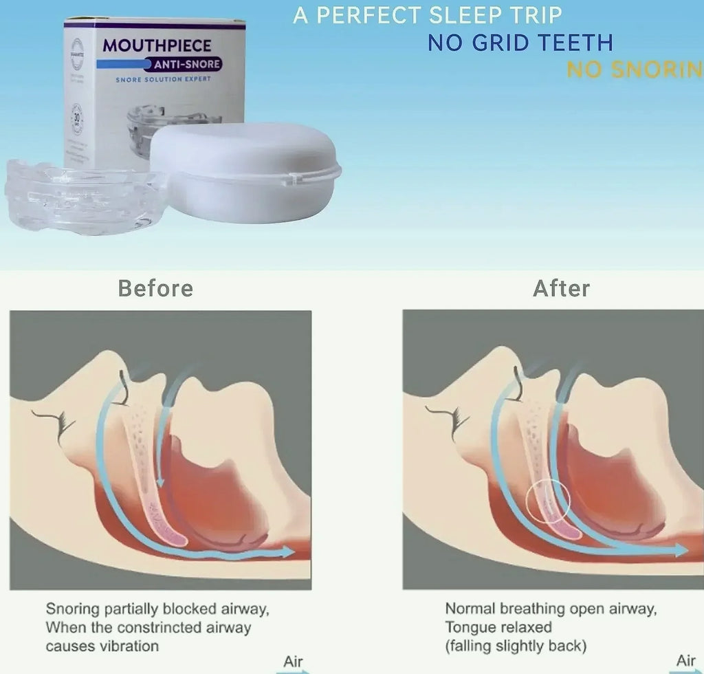 Adjustable Anti-Snoring Mouth Guard for Sleep Bruxism