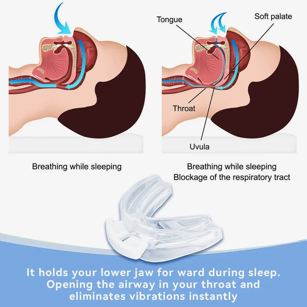 Stop Snoring Bruxism Silicone Mouth Guard Improve Sleeping Teeth Bruxism