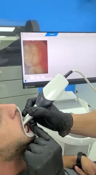SIRONA CEREC OmniBeast + MCXL Milling Unit + Ivoclar Furnace