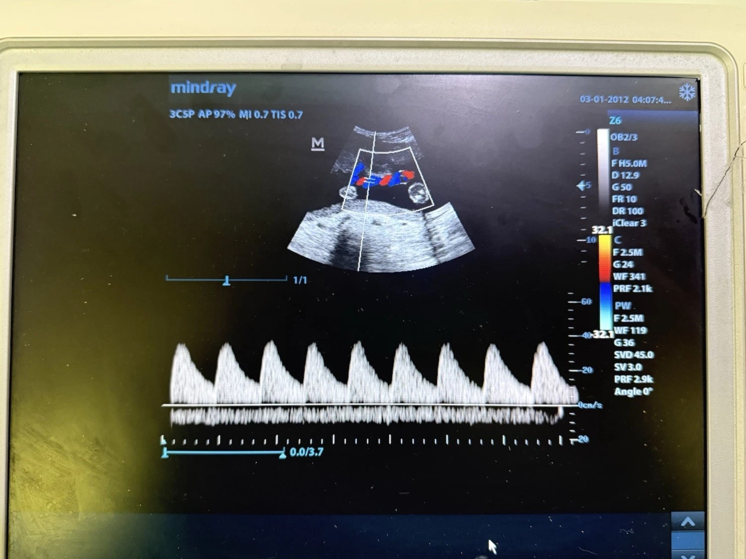 Mindray Z6 Ultrasound Machine w/ 2 Probes (7L4P & 3C5P) 2014 Color Doppler