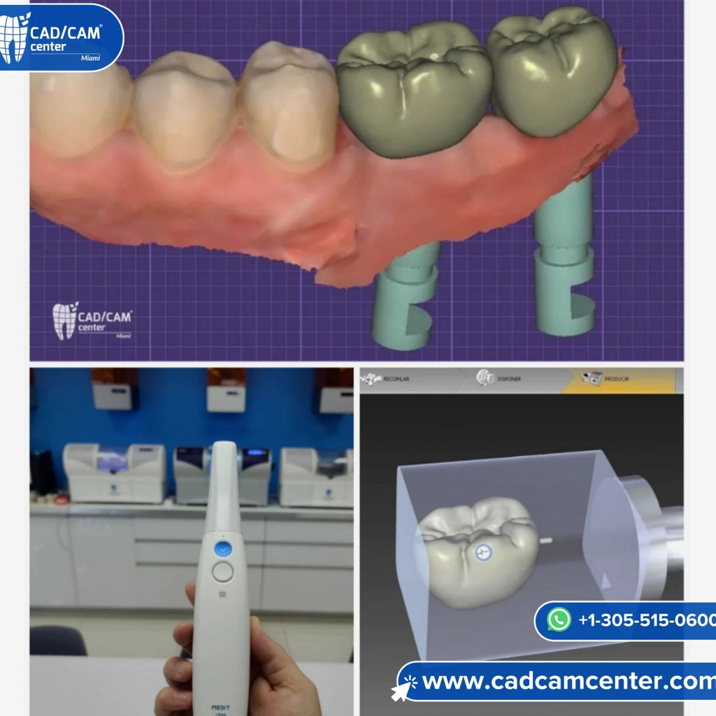 Medit i700 + SIRONA CEREC MCXL + Ivoclar CS Oven - Complete Chairside System