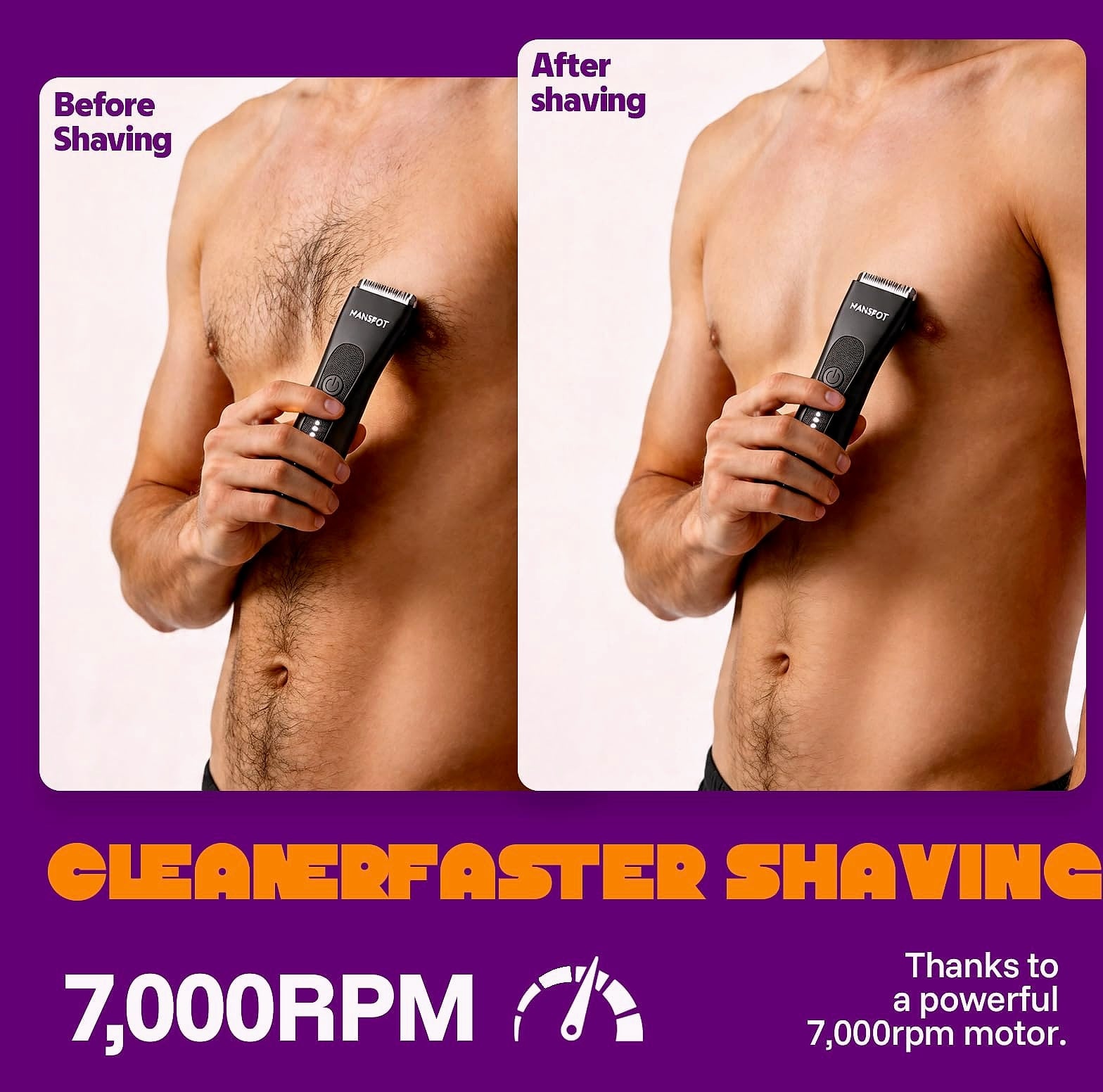 MANSPOT Groin Body Hair Trimmer with 4 Guards and Ceramic Blades