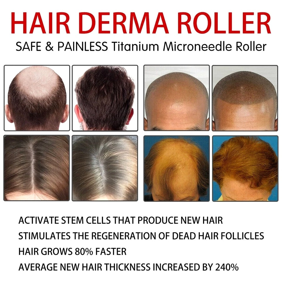 Beard Derma Roller for Hair Loss and Fast Beard Growth, Titanium Top Quality