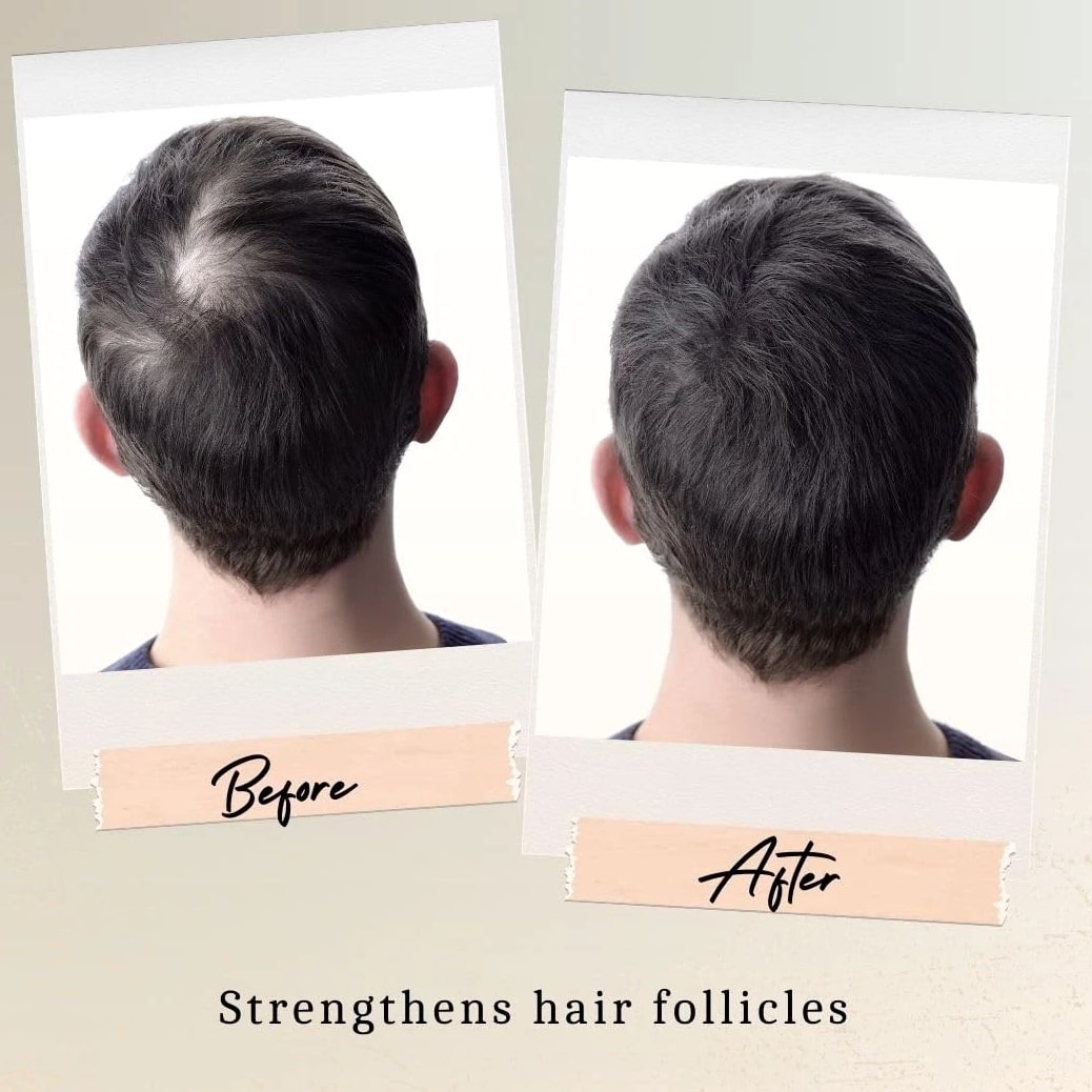 Belle Morgane Hair Growth with E, Turmeric & Argan Oil - Organic Dry Scalp Tre...
