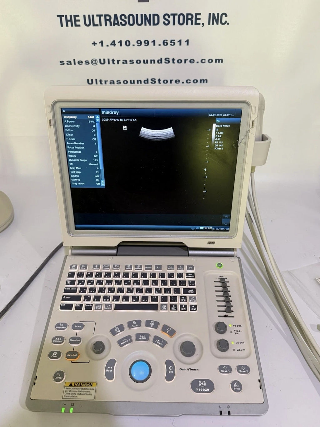 Mindray Z6 Ultrasound Machine w/ 2 Probes (7L4P & 3C5P) 2014 Color Doppler