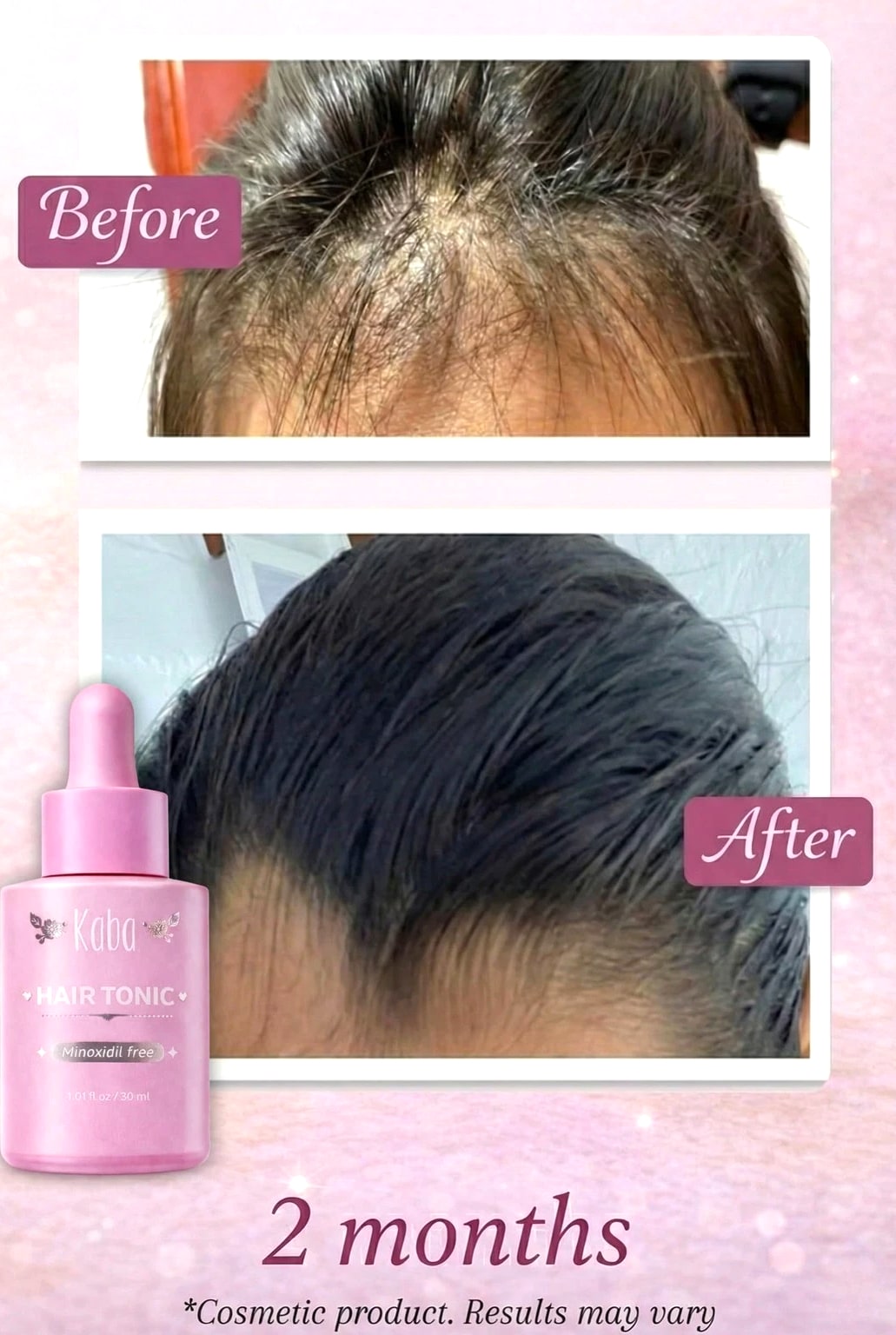 Kaba Tonic Hair Growth - Hair Loss Treatments, Hair Growth Products for Women...