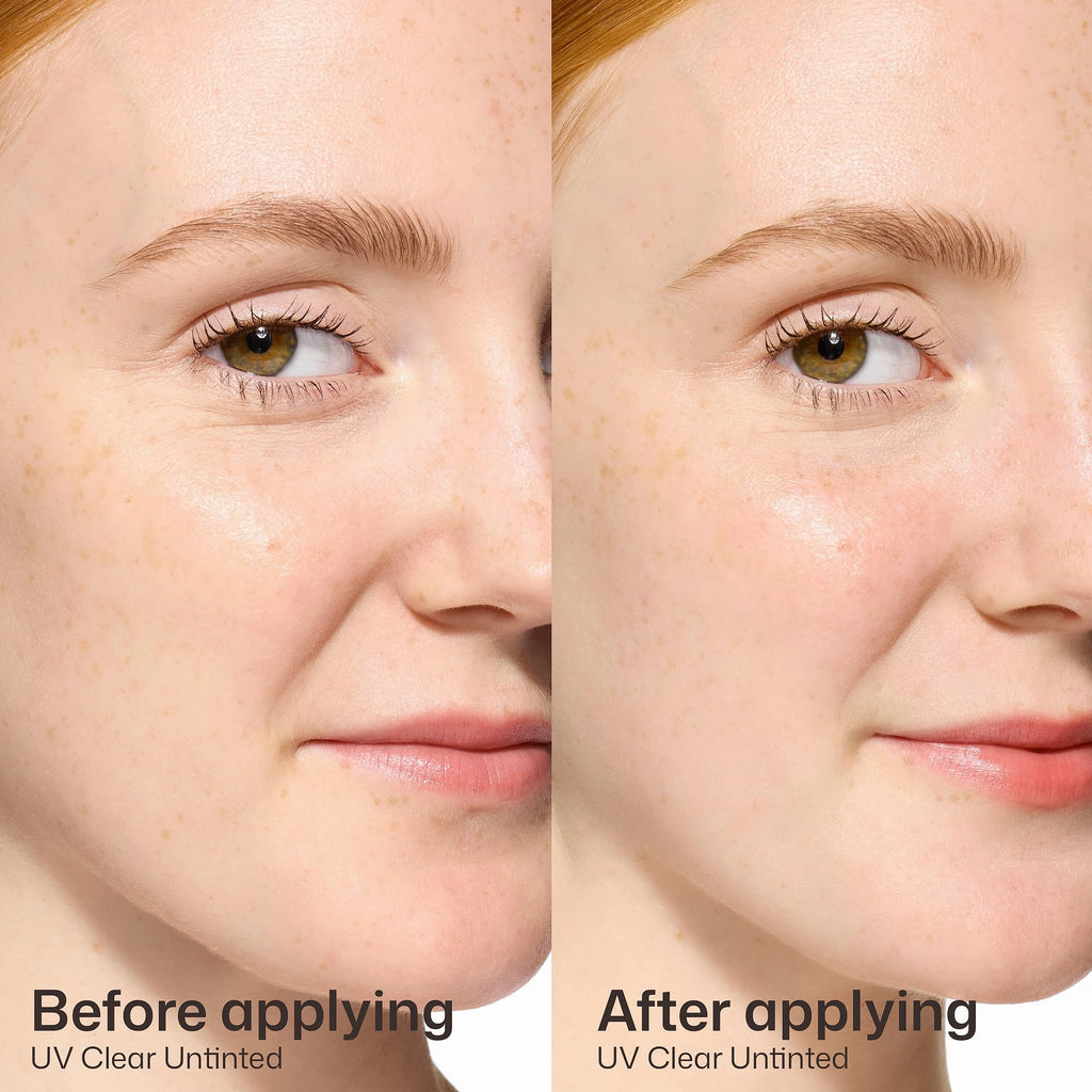 EltaMD UV Clear Face Sunscreen SPF 46 Oil-Free Sunscreen