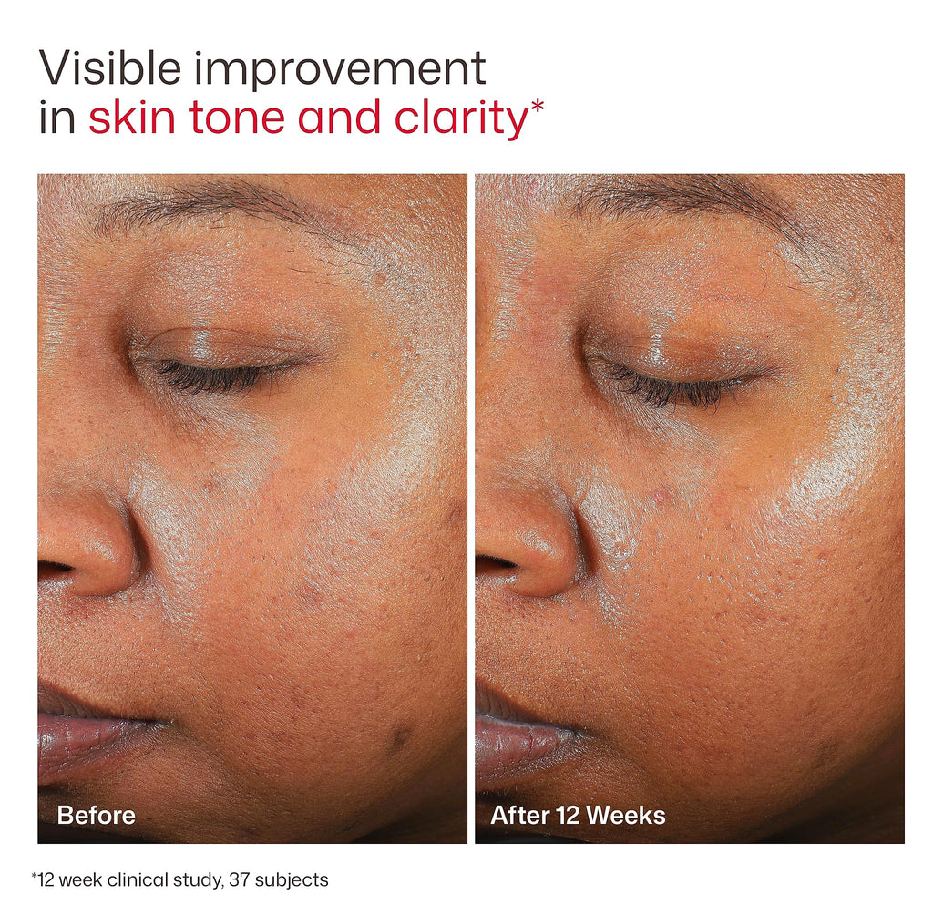 EltaMD UV Clear Face Sunscreen SPF 46 Oil-Free Sunscreen