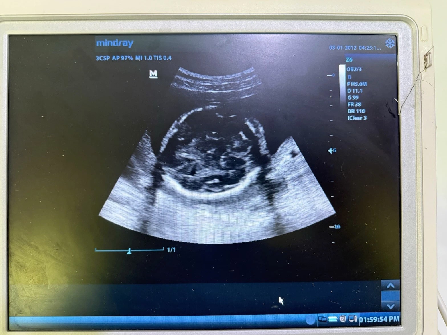 Mindray Z6 Ultrasound Machine w/ 2 Probes (7L4P & 3C5P) 2014 Color Doppler